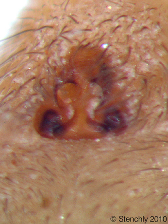 trocruri_f_2_large